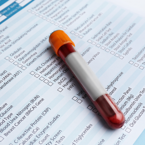 Cortisol 4-Point Test